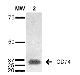 Western Blot - Anti-CD74 Antibody [1B8 ] (A304844) - Antibodies.com