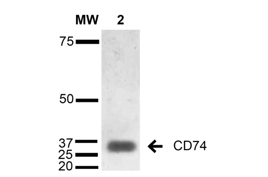 Western Blot - Anti-CD74 Antibody [1B8 ] (A304844) - Antibodies.com