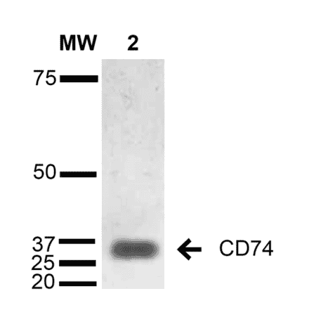 Western Blot - Anti-CD74 Antibody [1B8 ] (A304844) - Antibodies.com