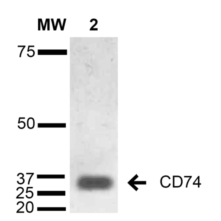Western Blot - Anti-CD74 Antibody [1B8 ] (A304844) - Antibodies.com