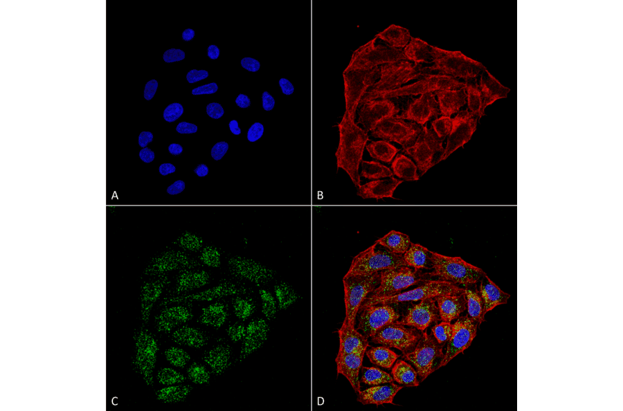 Immunocytochemistry/Immunofluorescence - Anti-CD74 Antibody [1B8 ] (A304844) - Antibodies.com