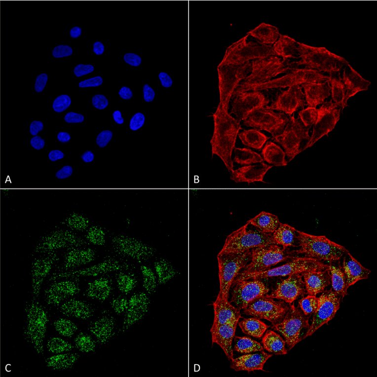 Immunocytochemistry/Immunofluorescence - Anti-CD74 Antibody [1B8 ] (A304844) - Antibodies.com