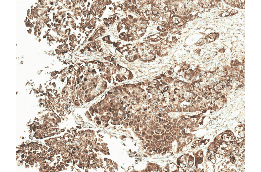 Immunohistochemistry - Anti-VDAC1 / Porin Antibody (A304848) - Antibodies.com