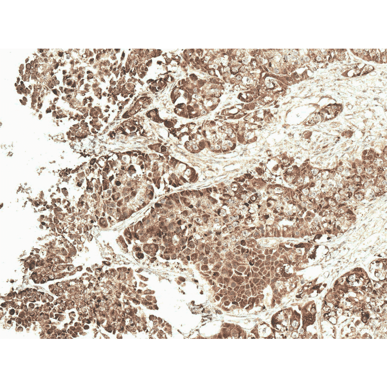 Immunohistochemistry - Anti-VDAC1 / Porin Antibody (A304848) - Antibodies.com