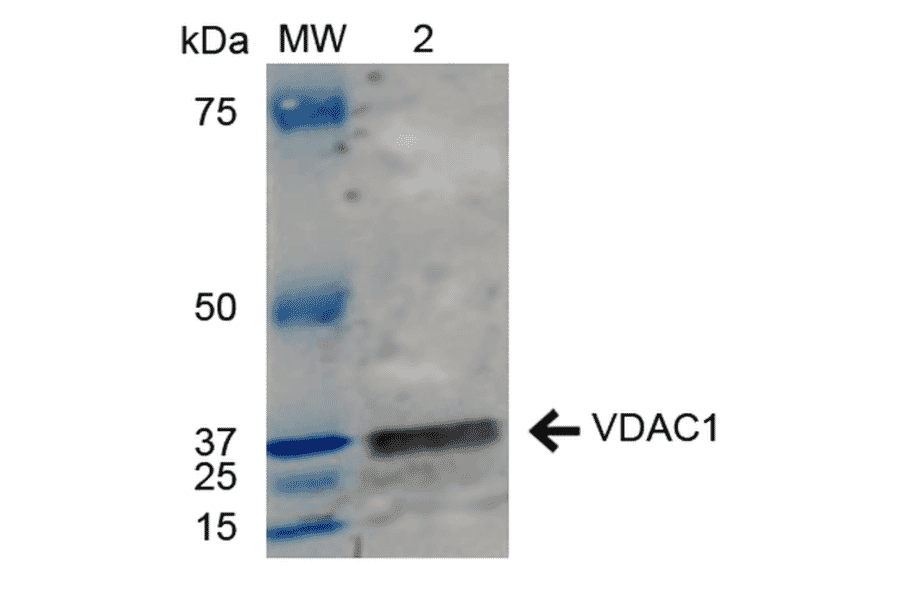 Western Blot - Anti-VDAC1 / Porin Antibody (A304848) - Antibodies.com