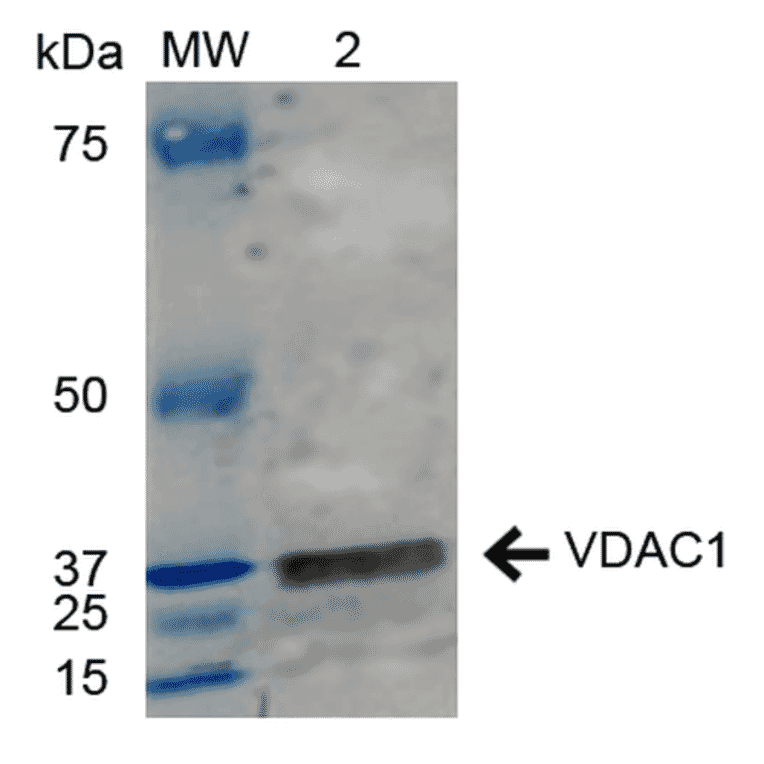 Western Blot - Anti-VDAC1 / Porin Antibody (A304848) - Antibodies.com
