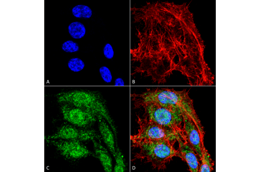 Immunocytochemistry/Immunofluorescence - Anti-VDAC1 / Porin Antibody (A304848) - Antibodies.com