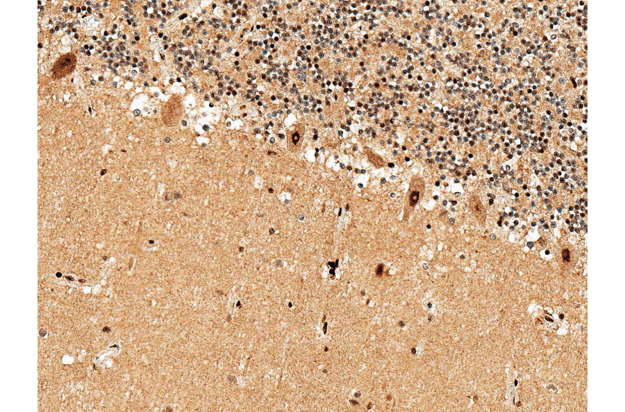 Immunohistochemistry - Anti-Adenosine A1 Receptor Antibody (A304849) - Antibodies.com