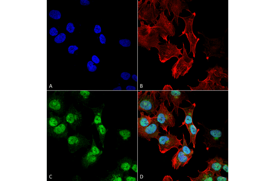 Immunocytochemistry/Immunofluorescence - Anti-Adenosine A1 Receptor Antibody (A304849) - Antibodies.com