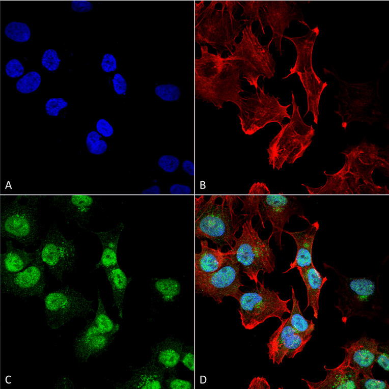 Immunocytochemistry/Immunofluorescence - Anti-Adenosine A1 Receptor Antibody (A304849) - Antibodies.com