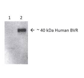 Western Blot - Anti-BVR Antibody (A304851) - Antibodies.com