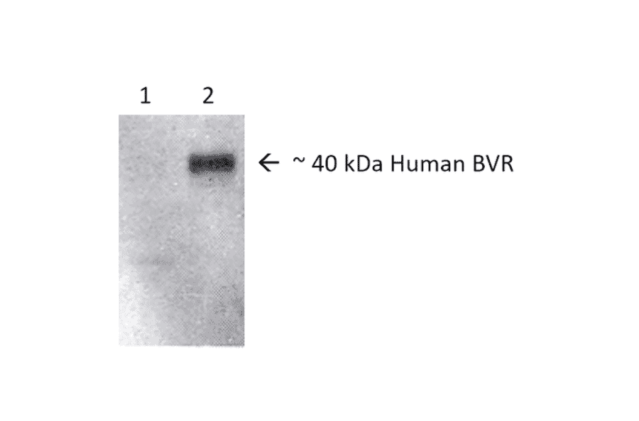 Western Blot - Anti-BVR Antibody (A304851) - Antibodies.com