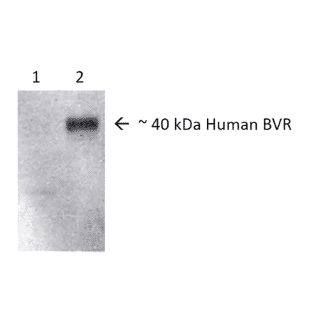 Western Blot - Anti-BVR Antibody (A304851) - Antibodies.com