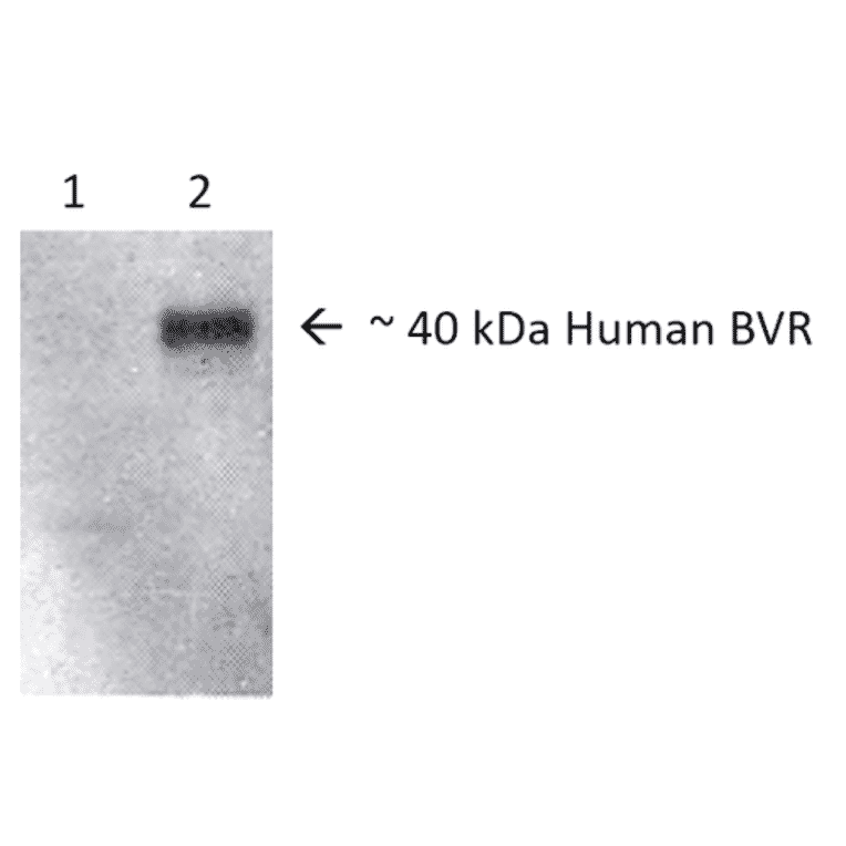 Western Blot - Anti-BVR Antibody (A304851) - Antibodies.com