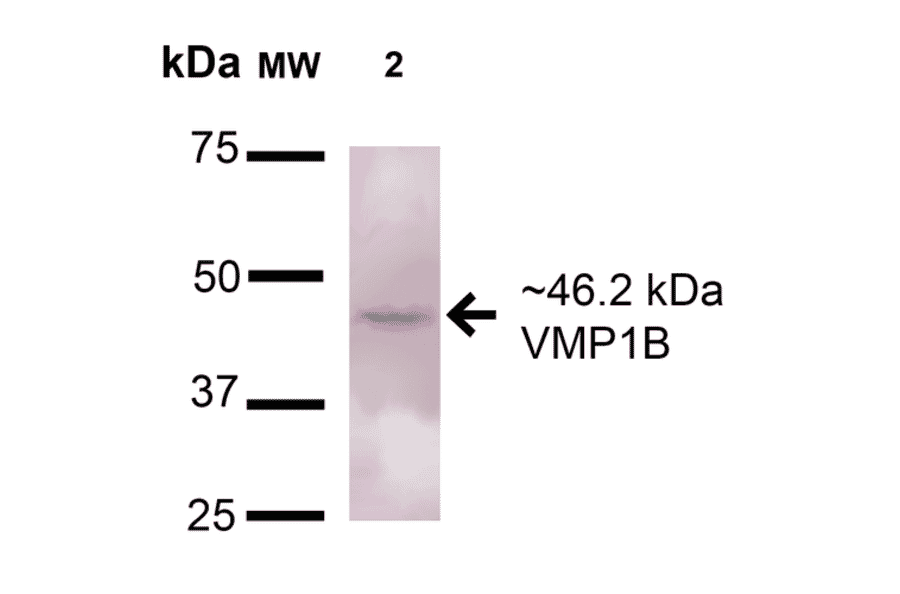 Western Blot - Anti-TMEM49 / VMP1 Antibody (A304853) - Antibodies.com