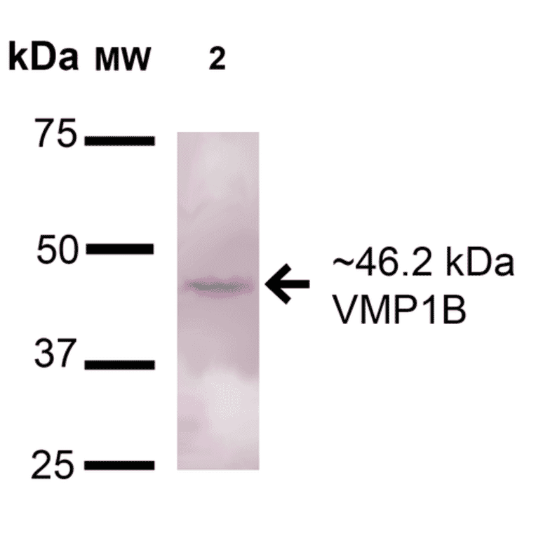 Western Blot - Anti-TMEM49 / VMP1 Antibody (A304853) - Antibodies.com