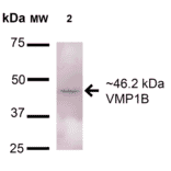 Western Blot - Anti-TMEM49 / VMP1 Antibody (A304853) - Antibodies.com