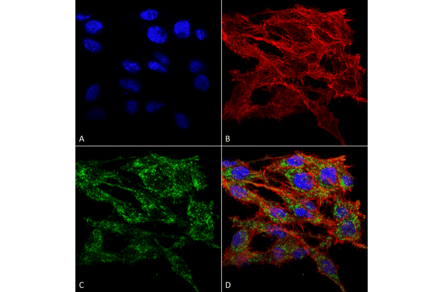 Immunocytochemistry/Immunofluorescence - Anti-TMEM49 / VMP1 Antibody (A304853) - Antibodies.com