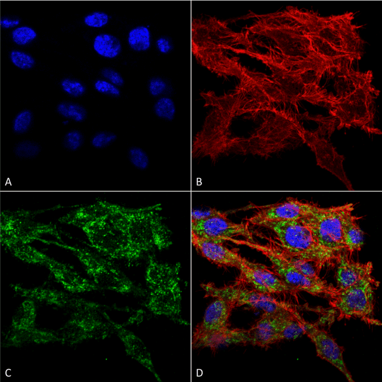 Immunocytochemistry/Immunofluorescence - Anti-TMEM49 / VMP1 Antibody (A304853) - Antibodies.com