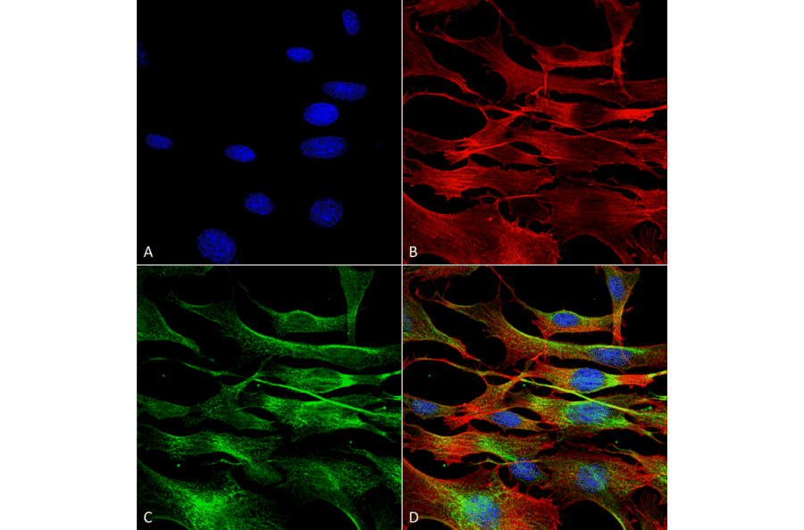 Immunocytochemistry/Immunofluorescence - Anti-alpha Tubulin Antibody (A304857) - Antibodies.com