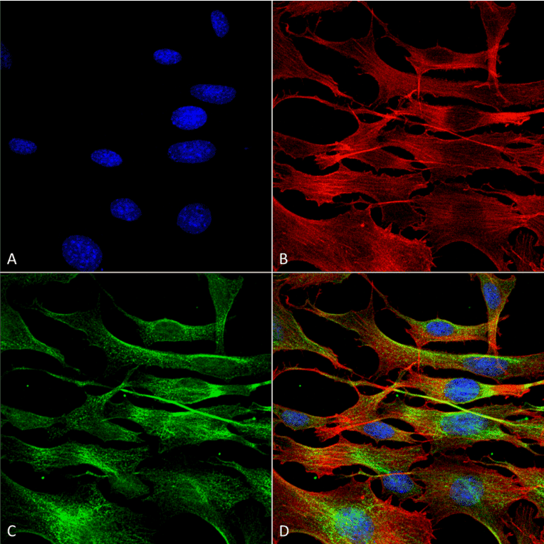 Immunocytochemistry/Immunofluorescence - Anti-alpha Tubulin Antibody (A304857) - Antibodies.com