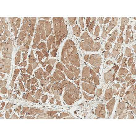 Immunohistochemistry - Anti-WIPI2 Antibody (A304859) - Antibodies.com
