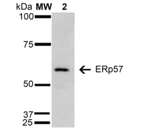 Western Blot - Anti-ERp57 Antibody [4F9] (A304860) - Antibodies.com