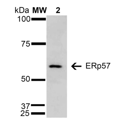 Western Blot - Anti-ERp57 Antibody [4F9] (A304860) - Antibodies.com