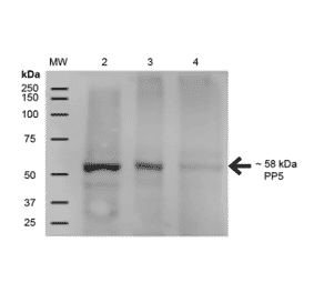 Western Blot - Anti-PP-T Antibody [12F7] (A304861) - Antibodies.com