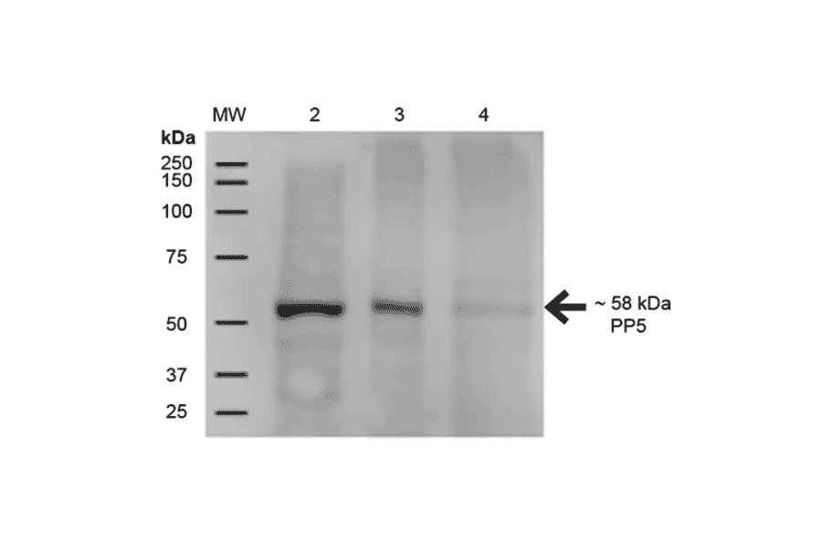 Western Blot - Anti-PP-T Antibody [12F7] (A304861) - Antibodies.com