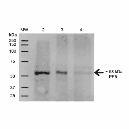 Western Blot - Anti-PP-T Antibody [12F7] (A304861) - Antibodies.com