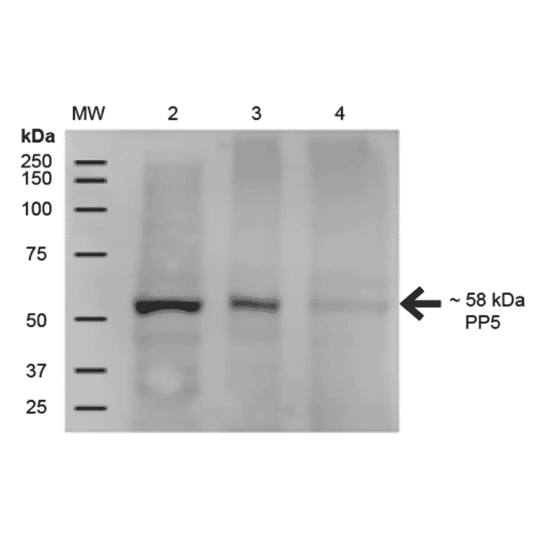 Western Blot - Anti-PP-T Antibody [12F7] (A304861) - Antibodies.com