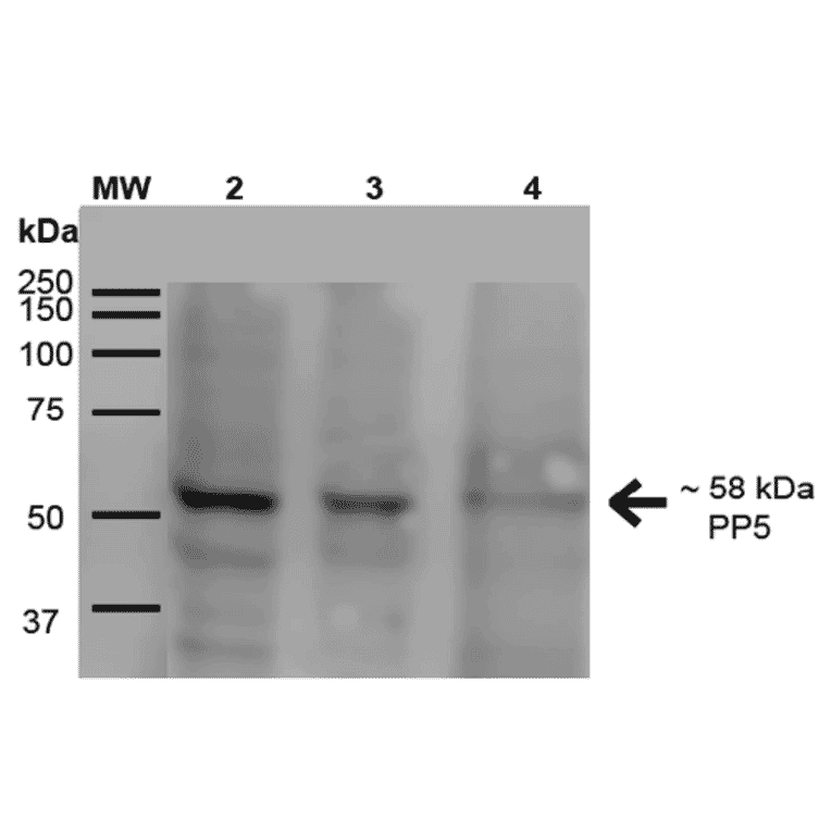 Western Blot - Anti-PP-T Antibody [2E11] (A304862) - Antibodies.com