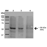 Western Blot - Anti-PP-T Antibody [2E11] (A304862) - Antibodies.com