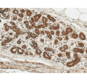 Immunohistochemistry - Anti-ESR1 Antibody (A304863) - Antibodies.com