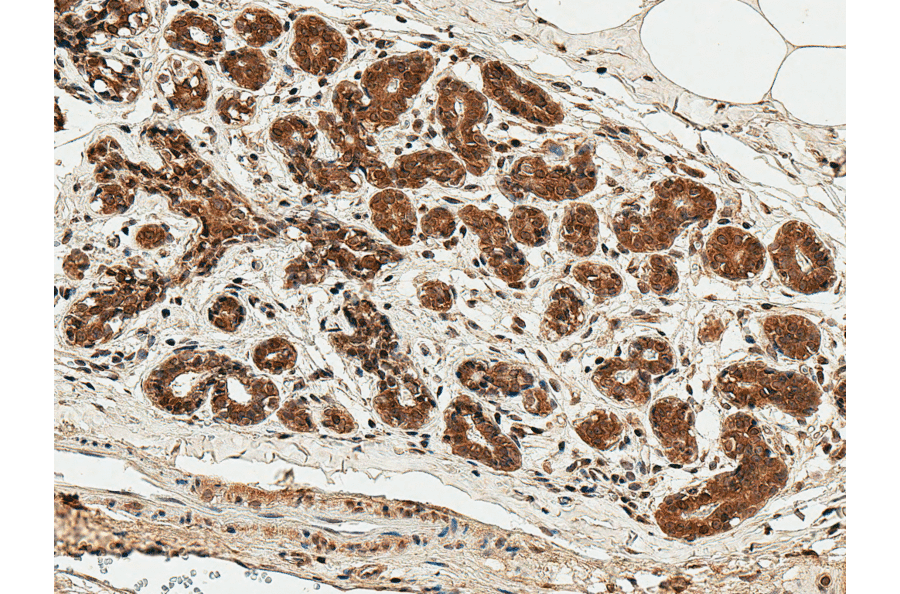 Immunohistochemistry - Anti-ESR1 Antibody (A304863) - Antibodies.com
