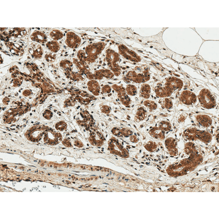 Immunohistochemistry - Anti-ESR1 Antibody (A304863) - Antibodies.com