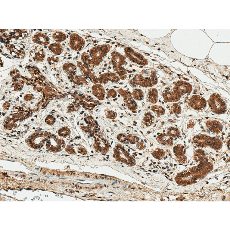 Immunohistochemistry - Anti-ESR1 Antibody (A304863) - Antibodies.com