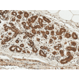 Immunohistochemistry - Anti-ESR1 Antibody (A304863) - Antibodies.com