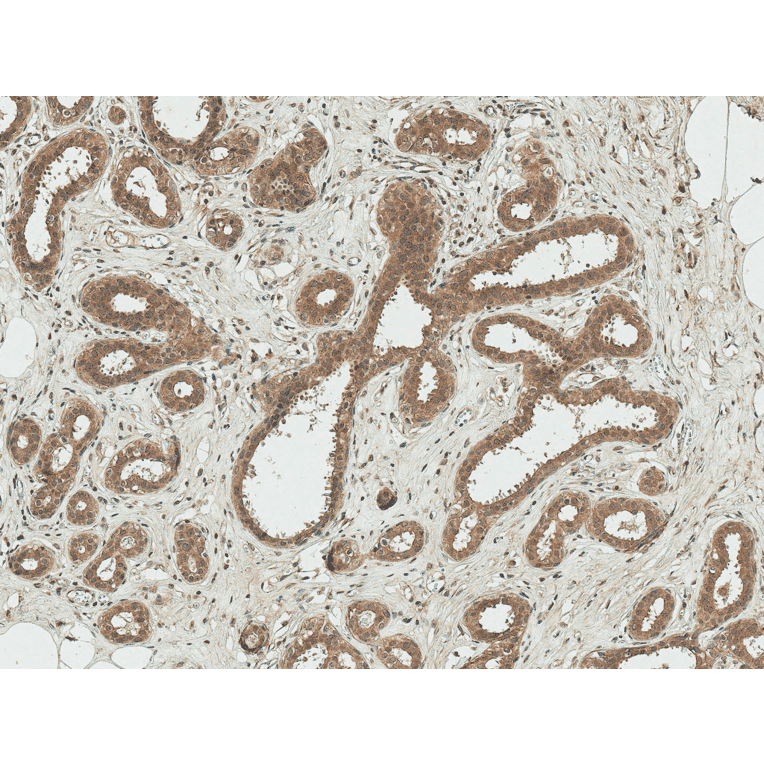 Immunohistochemistry - Anti-ESR1 Antibody (A304863) - Antibodies.com