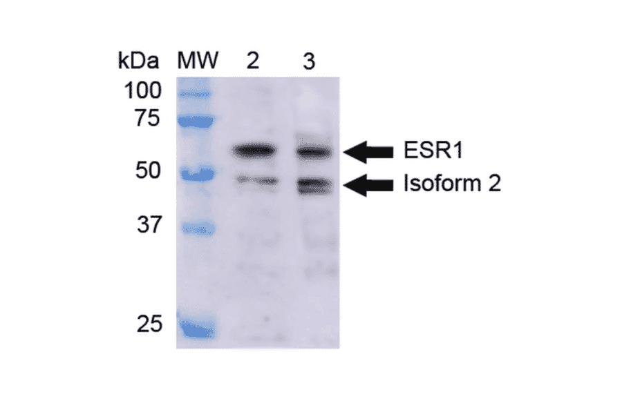 Western Blot - Anti-ESR1 Antibody (A304863) - Antibodies.com