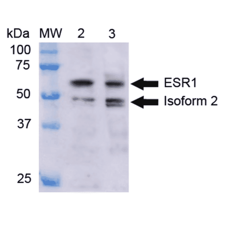 Western Blot - Anti-ESR1 Antibody (A304863) - Antibodies.com