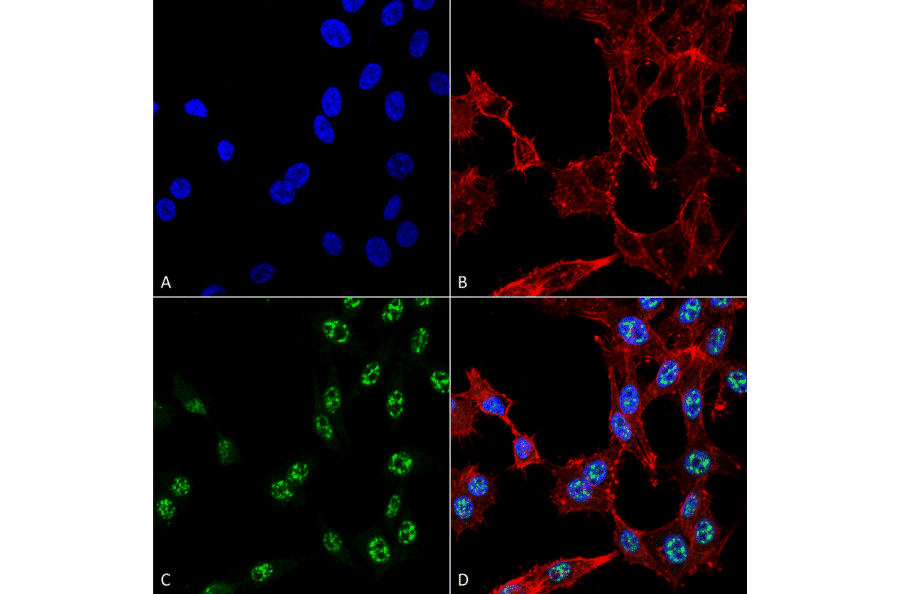 Immunocytochemistry/Immunofluorescence - Anti-ESR1 Antibody (A304863) - Antibodies.com