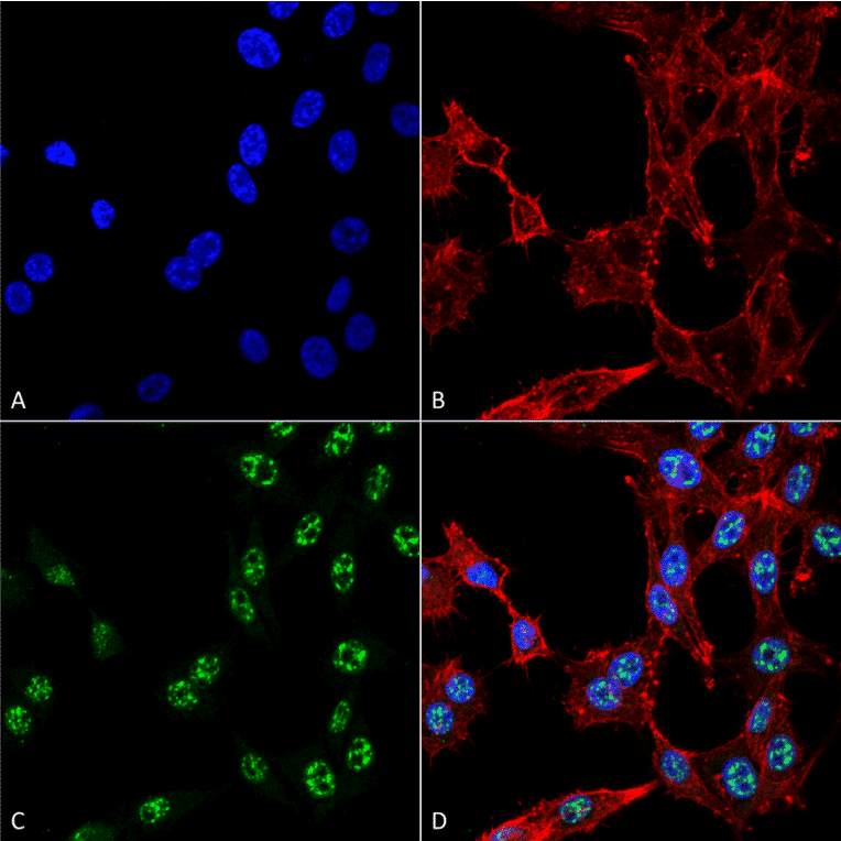 Immunocytochemistry/Immunofluorescence - Anti-ESR1 Antibody (A304863) - Antibodies.com