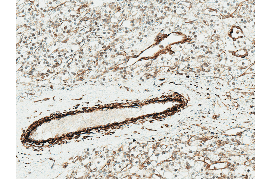 Immunohistochemistry - Anti-NRF2 Antibody (A304864) - Antibodies.com