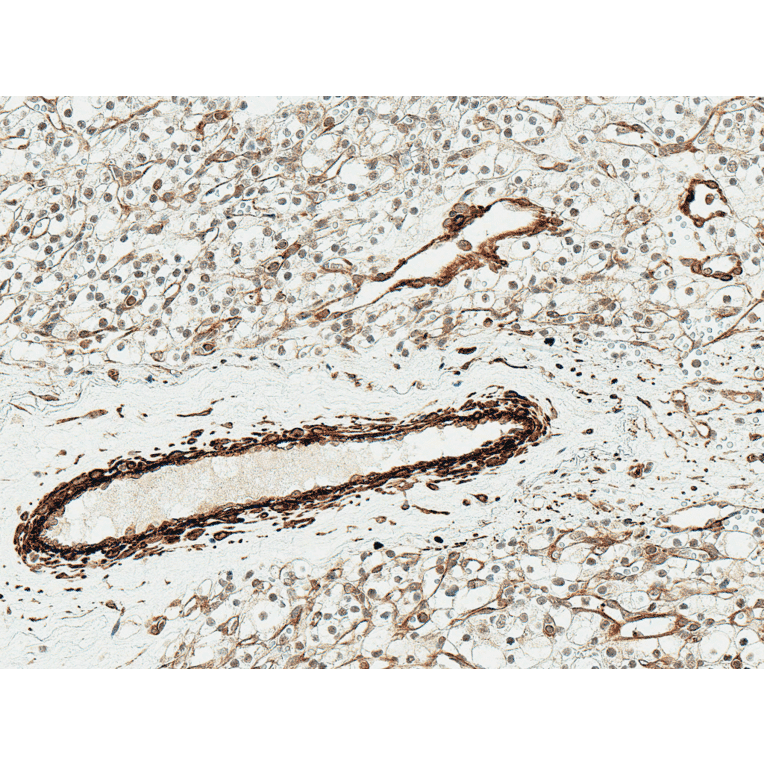Immunohistochemistry - Anti-NRF2 Antibody (A304864) - Antibodies.com