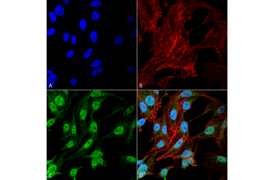 Immunocytochemistry/Immunofluorescence - Anti-NRF2 Antibody (A304864) - Antibodies.com
