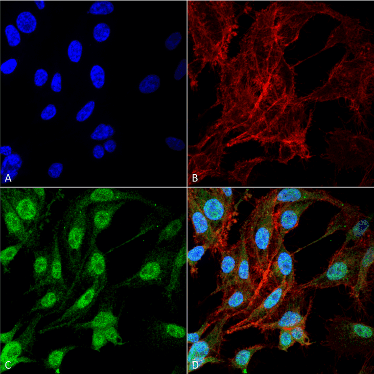 Immunocytochemistry/Immunofluorescence - Anti-NRF2 Antibody (A304864) - Antibodies.com