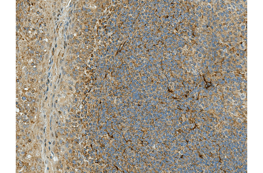 Immunohistochemistry - Anti-Rubicon / Baron Antibody (A304866) - Antibodies.com