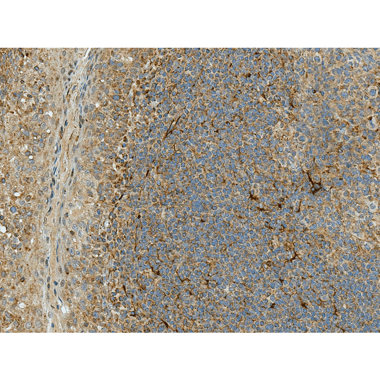 Immunohistochemistry - Anti-Rubicon / Baron Antibody (A304866) - Antibodies.com